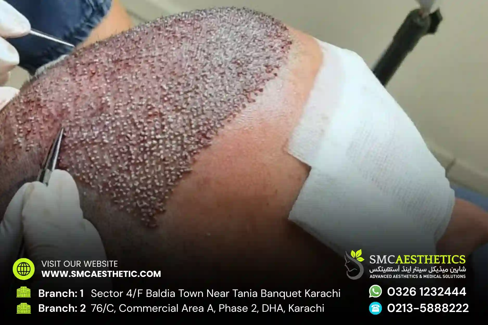 SMC Aesthetics Surgical Facility in Karachi